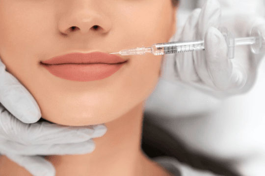 Labios con Ácido Hialurónico
